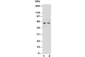 Western blot testing of NOX1 antibody and Lane 1:  HeLa;  2: MCF-7 cell lysate (NOX1 antibody  (AA 354-374))