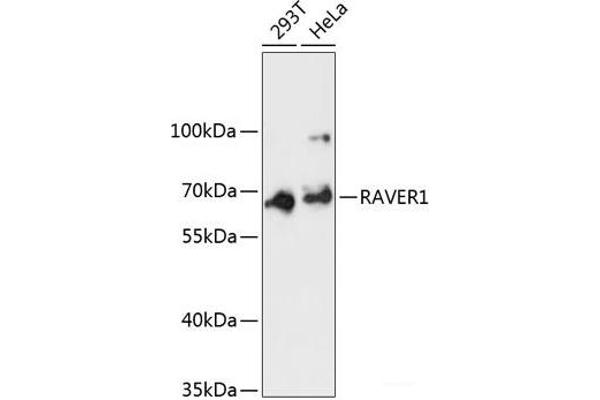 RAVER1 anticorps