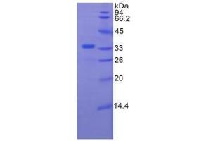 SDS-PAGE analysis of Human Plexin B1 Protein. (PLXNB1 Protein)