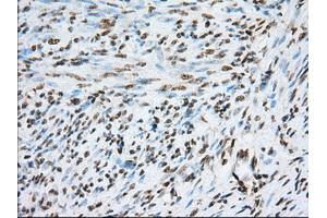 Immunohistochemistry (IHC) image for anti-Transforming, Acidic Coiled-Coil Containing Protein 3 (TACC3) antibody (ABIN1498099) (TACC3 antibody)