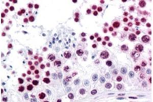 Immunohistochemistry (Formalin-fixed Paraffin-embedded Sections) (IHC (fp)) image for anti-High Mobility Group Box 1 (HMGB1) (AA 1-216) antibody (ABIN574266)
