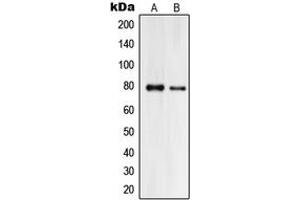 Western blot analysis of Praja2 expression in HeLa (A), HL60 (B) whole cell lysates.