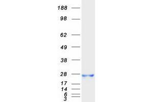 Validation with Western Blot (GM2A Protein (Myc-DYKDDDDK Tag))