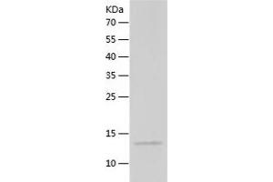 Western Blotting (WB) image for CD59 (CD59) (AA 26-102) protein (His tag) (ABIN7285387) (CD59 Protein (CD59) (AA 26-102) (His tag))