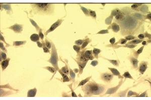 Image no. 3 for anti-Heat Shock Protein 70 (HSP70) (AA 436-503) antibody (ABIN466875) (HSP70 antibody  (AA 436-503))