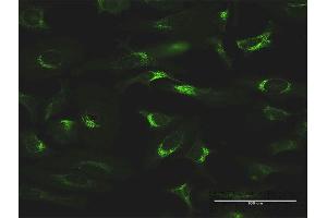 Immunofluorescence of monoclonal antibody to FTL on HeLa cell. (FTL antibody  (AA 1-175))