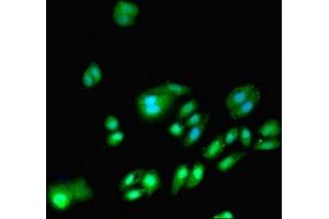 Immunofluorescent analysis of HepG2 cells using ABIN7150112 at dilution of 1:100 and Alexa Fluor 488-congugated AffiniPure Goat Anti-Rabbit IgG(H+L) (DNMT3A antibody  (AA 680-902))