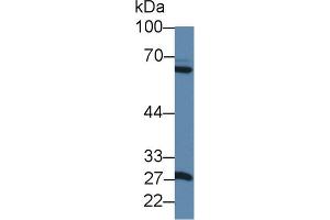 Western blot analysis of Rat Pancreas lysate, using Rat MMP1 Antibody (1 µg/ml) and HRP-conjugated Goat Anti-Rabbit antibody (