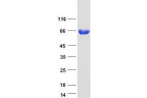Validation with Western Blot (ACSS3 Protein (Myc-DYKDDDDK Tag))