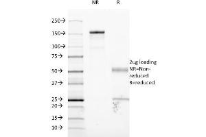 SDS-PAGE (SDS) image for anti-Intercellular Adhesion Molecule 1 (ICAM1) antibody (ABIN6939678)