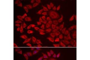 Immunofluorescence analysis of HeLa cells using AGPAT2 Polyclonal Antibody (AGPAT2 antibody)