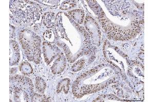 IHC analysis of MCM6 using anti-MCM6 antibody (ABIN7600035).