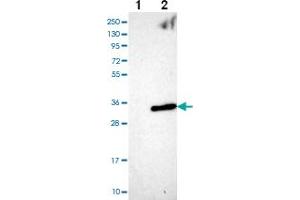 Western blot analysis of Lane 1: Negative control (vector only transfected HEK293T lysate) Lane 2: Over-expression Lysate (Co-expressed with a C-terminal myc-DDK tag (~3. (ANKRD46 antibody)