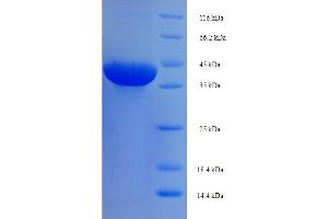 SDS-PAGE (SDS) image for Butyrophilin, Subfamily 3, Member A1 (BTN3A1) (AA 30-254) protein (His-SUMO Tag) (ABIN5709153)