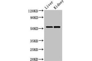 Western Blot Positive WB detected in: Mouse liver tissue, Mouse kidney tissue All lanes: PNLIPRP3 antibody at 3. (PNLIPRP3 antibody  (AA 201-467))