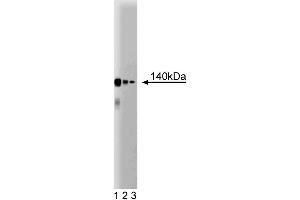 Western blot analysis of CTCF on a Jurkat cell lysate (Human T-cell leukemia, ATCC TIB-152). (CTCF antibody  (AA 184-290))