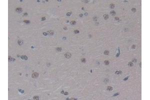 Immunohistochemistry (IHC) image for anti-Coagulation Factor XIII, A1 Polypeptide (F13A1) (AA 140-377) antibody (ABIN7440509)