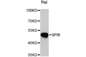 Western blot analysis of extracts of Raji cells, using SPIB antibody. (SPIB antibody)