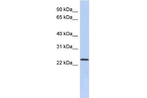 WB Suggested Anti-ULBP1 Antibody Titration:  0.