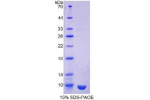 SDS-PAGE analysis of Human Clara Cell Protein 16 Protein. (SCGB1A1 Protein)