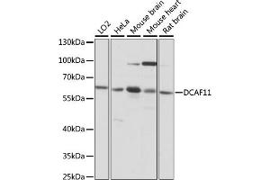 Western blot analysis of extracts of various cell lines, using DC antibody (ABIN7266680) at 1:1000 dilution. (DCAF11 antibody  (AA 1-170))