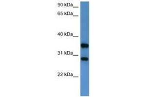 STYXL1 anticorps  (AA 140-189)