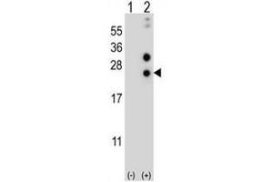 Western blot analysis of CSN1S1 (arrow) using rabbit polyclonal CSN1S1 Antibody (Center) . (Casein alpha S1 antibody  (Middle Region))