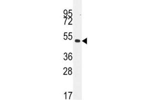Western Blotting (WB) image for anti-Desmin (DES) (AA 1-30) antibody (ABIN3030717)