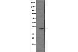 Western blot analysis of OR51E2 Antibody expression in JK cells lysates. (PSGR antibody  (Internal Region))