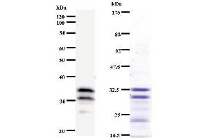 Left: TUBD1 staining. (TUBD1 antibody)