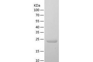 Western Blotting (WB) image for Zinc Finger Protein 133 (ZNF133) (AA 388-635) protein (His tag) (ABIN7286433) (ZNF133 Protein (AA 388-635) (His tag))