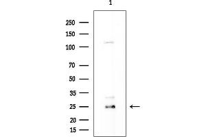 Western blot analysis of lysates from COLO205 cells, using OR10 Antibody at 1/1000 dilution.