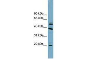 Image no. 1 for anti-Chromosome 4 Open Reading Frame 20 (C4orf20) (AA 287-336) antibody (ABIN6744145) (UFSP2 antibody  (AA 287-336))