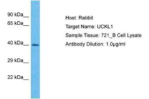 Host: Rabbit Target Name: UCKL1 Sample Type: 721_B Whole cell lysates Antibody Dilution: 1. (UCKL1 antibody  (N-Term))