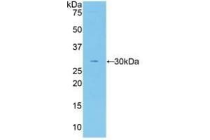 Detection of Recombinant F5, Human using Polyclonal Antibody to Coagulation Factor V (F5) (Coagulation Factor V antibody  (AA 1979-2217))