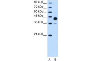 Western Blotting (WB) image for anti-Homeobox C10 (HOXC10) antibody (ABIN2461879)