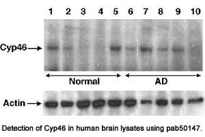 Image no. 1 for anti-Cytochrome P450, Family 46, Subfamily A, Polypeptide 1 (CYP46A1) antibody (ABIN363456)