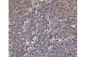 IHC analysis of EEF2 using anti-EEF2 antibody (ABIN7599561).