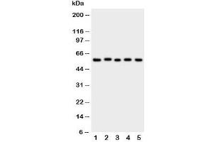 Western blot testing of ASIC3 antibody and Lane 1:  rat brain;  2: (r) testis;  3: human U87;  4: mouse Neuro-2a;  5: (h) SMMC-7721 cell lysate.