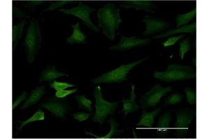 Immunofluorescence of monoclonal antibody to BCL7C on HeLa cell. (BCL7C antibody  (AA 86-164))