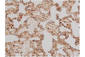 Immunohistochemistry (IHC) image for anti-Filamin A, alpha (FLNA) (pSer2152) antibody (ABIN6256196)