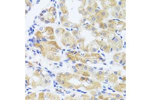 Immunohistochemistry of paraffin-embedded human stomach using INADL antibody at dilution of 1:100 (x40 lens). (PATJ antibody)