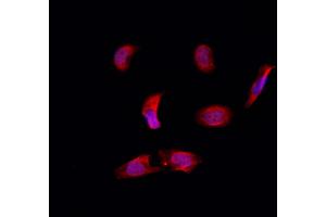 ABIN6257639 and ABIN6274782 staining Hela by IF/ICC. (RPL39 antibody  (C-Term))