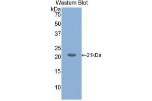 Western Blotting (WB) image for anti-Von Willebrand Factor (VWF) (AA 1498-1665) antibody (ABIN1078669) (VWF antibody  (AA 1498-1665))