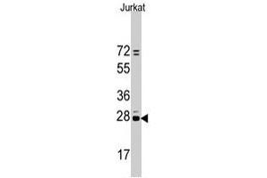 Western blot analysis of CD9 polyclonal antibody  in Jurkat cell line lysates (35 ug/lane). (CD9 antibody  (N-Term))