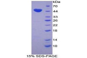 SDS-PAGE (SDS) image for Chromogranin B (Secretogranin 1) (CHGB) (AA 309-484) protein (His tag,GST tag) (ABIN1877922) (CHGB Protein (AA 309-484) (His tag,GST tag))