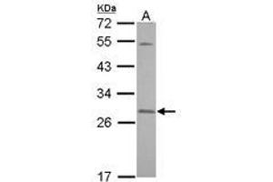 Image no. 2 for anti-Synaptosomal-Associated Protein, 23kDa (SNAP23) (AA 6-211) antibody (ABIN1501021) (SNAP23 antibody  (AA 6-211))