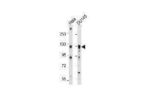 All lanes : Anti-AXL Antibody at 1:2000 dilution Lane 1: Hela whole cell lysate Lane 2: D whole cell lysate Lysates/proteins at 20 μg per lane. (AXL antibody)