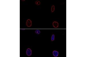 Confocal immunofluorescence analysis of U-2OS cells using Emerin/Emerin/EMD antibody  at dilution of 1:100.