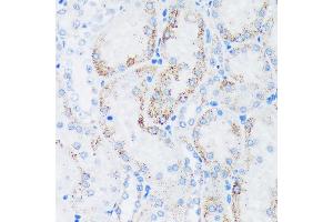 Immunohistochemistry of paraffin-embedded Rat kidney using GTPBP8 Rabbit pAb (ABIN7267527) at dilution of 1:100 (40x lens). (GTPBP8 antibody  (AA 1-170))